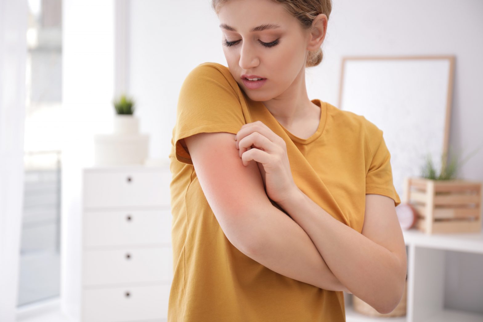 Woman scratching arm indoors, space for text. Allergy symptoms