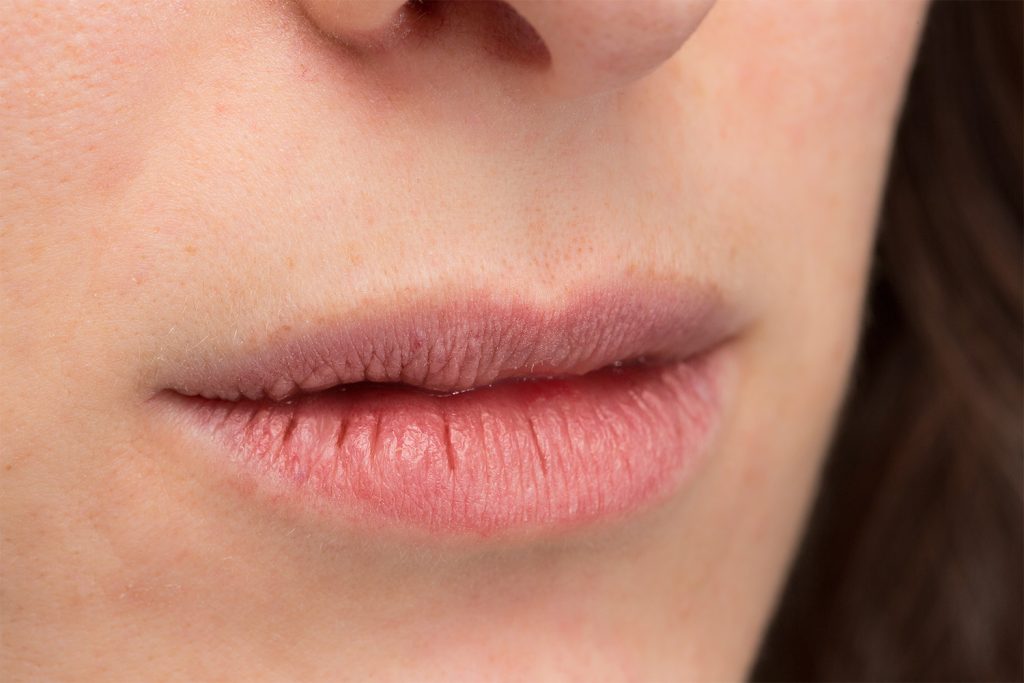 How to Fix Chapped Lips